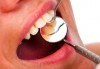 Обстоен преглед, почистване на зъбен камък и плака с ултразвук и полиране в ПримаДент Д-р Анита Ангелова - thumb 2