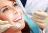 Обстоен преглед, почистване на зъбен камък и плака с ултразвук и полиране в ПримаДент Д-р Анита Ангелова - thumb 1