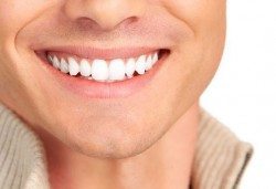 Кабинетно избелване на зъби с швейцарската система Pure Whitening System, почистване на зъбен камък, полиране и преглед в ПримаДент - д-р Анита Ангелова - Снимка