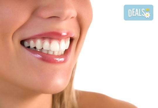 Обстоен преглед, почистване на зъбен камък и зъбна плака с ултразвук в дентална клиника Рай-Дент! - Снимка 2