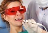 Обстоен преглед, почистване на зъбен камък и зъбна плака с ултразвук в дентална клиника Рай-Дент! - thumb 1